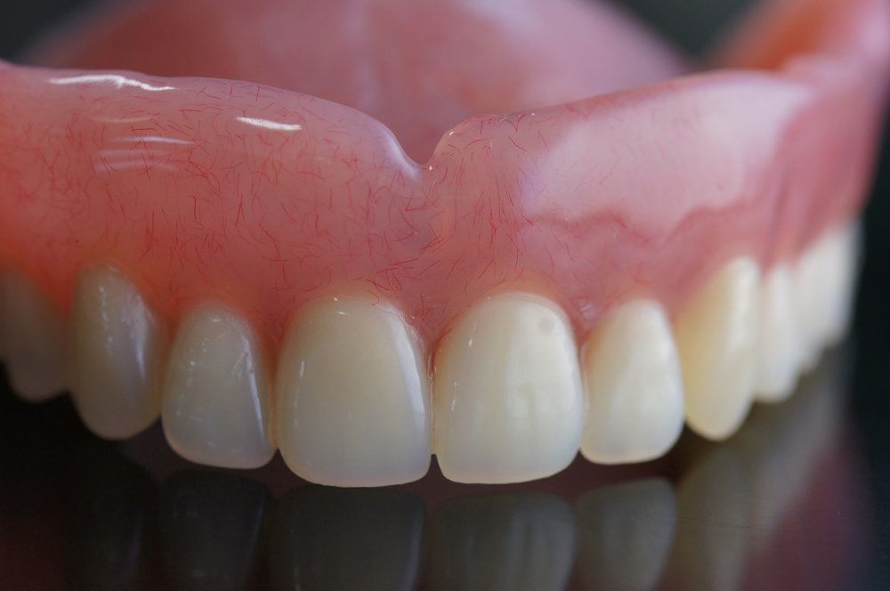 Dentures Restoration at Parkway Dental
