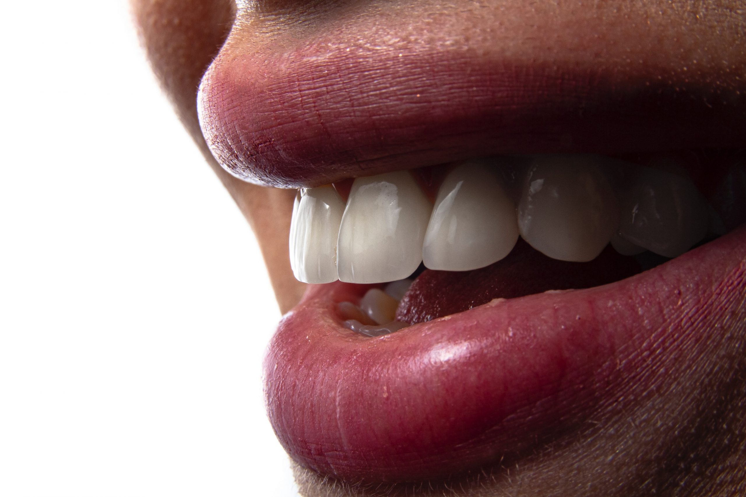 All About Dental Bone Graft in Hamden