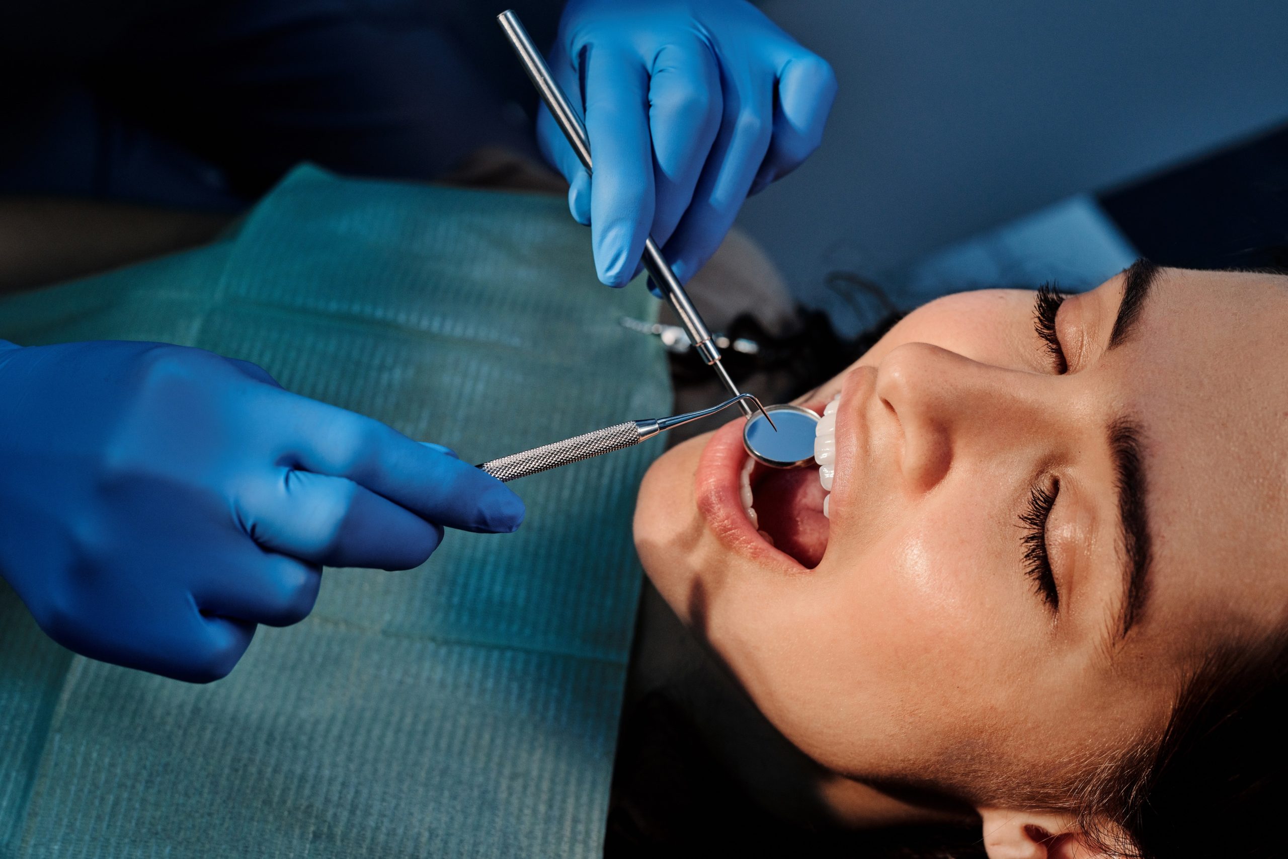 When to Consider Root Canal Therapy